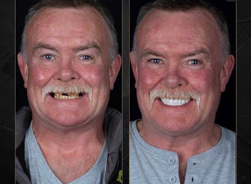Dental aesthetics result