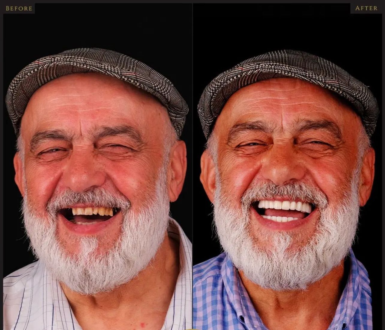 Dental aesthetics result