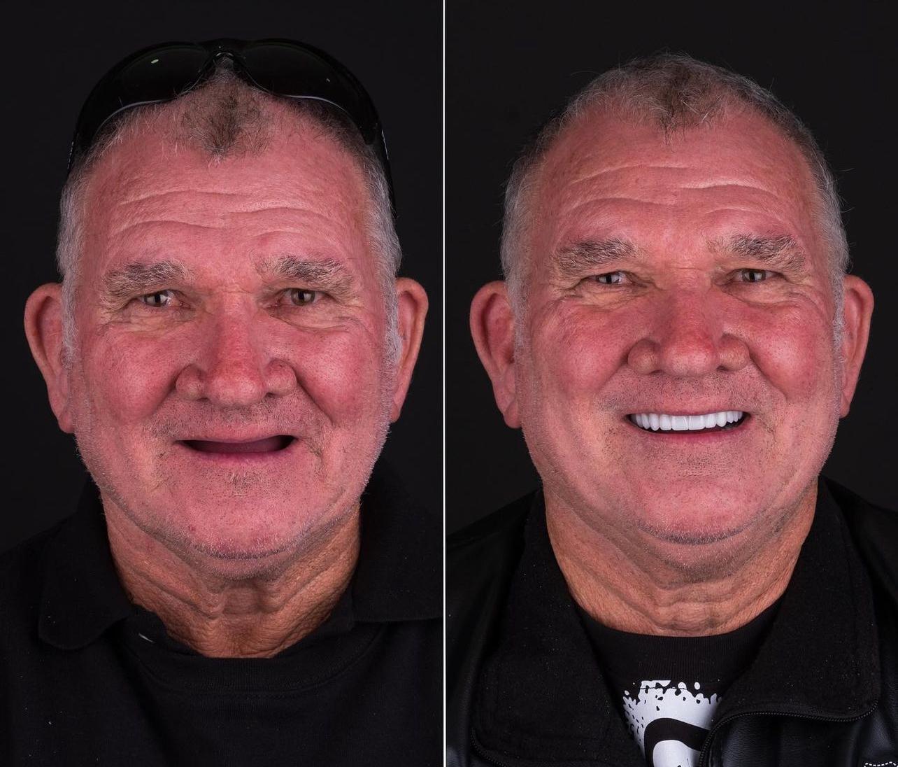 Dental aesthetics result