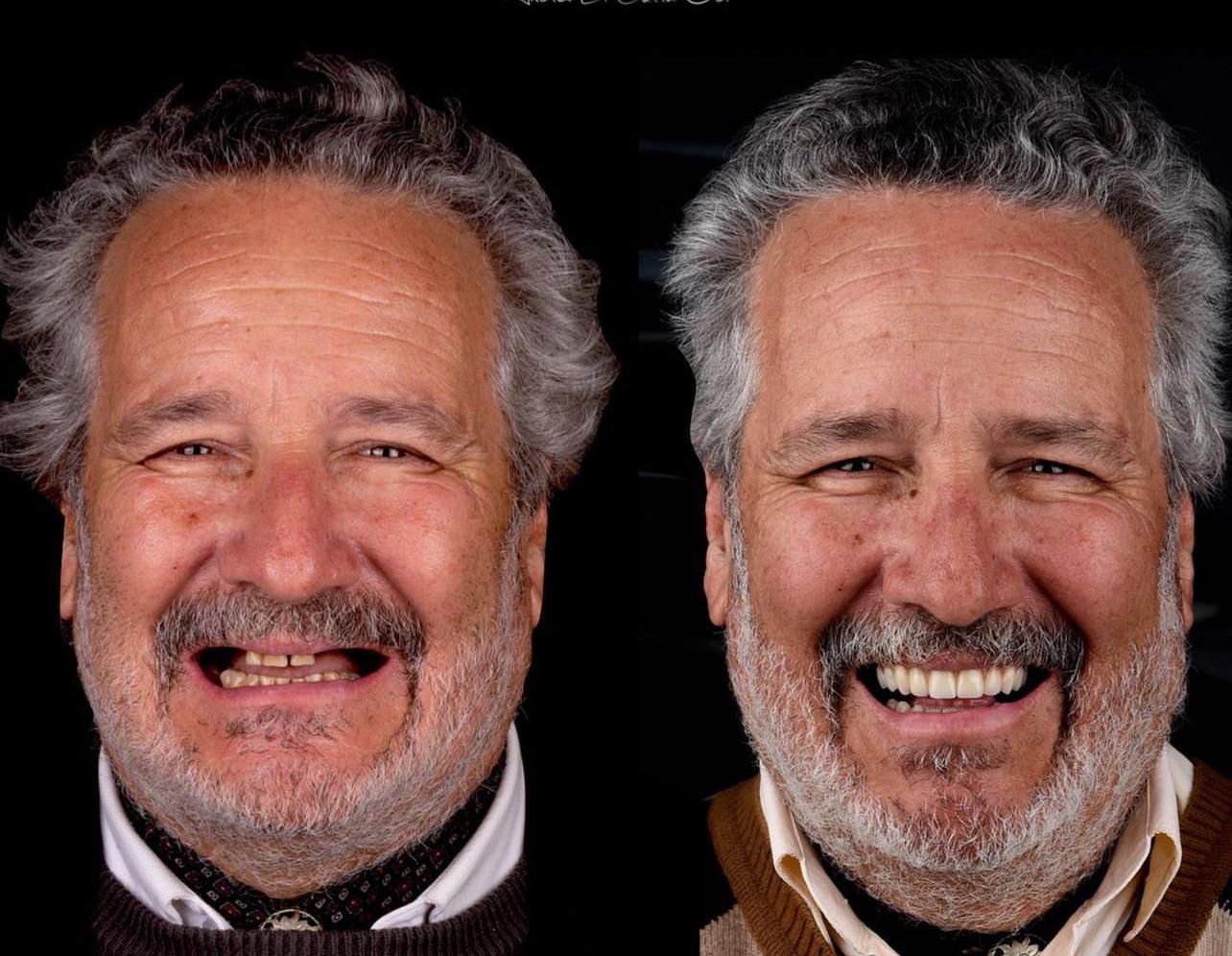 Dental aesthetics result