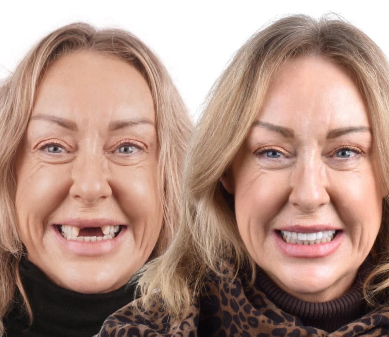 Dental aesthetics result
