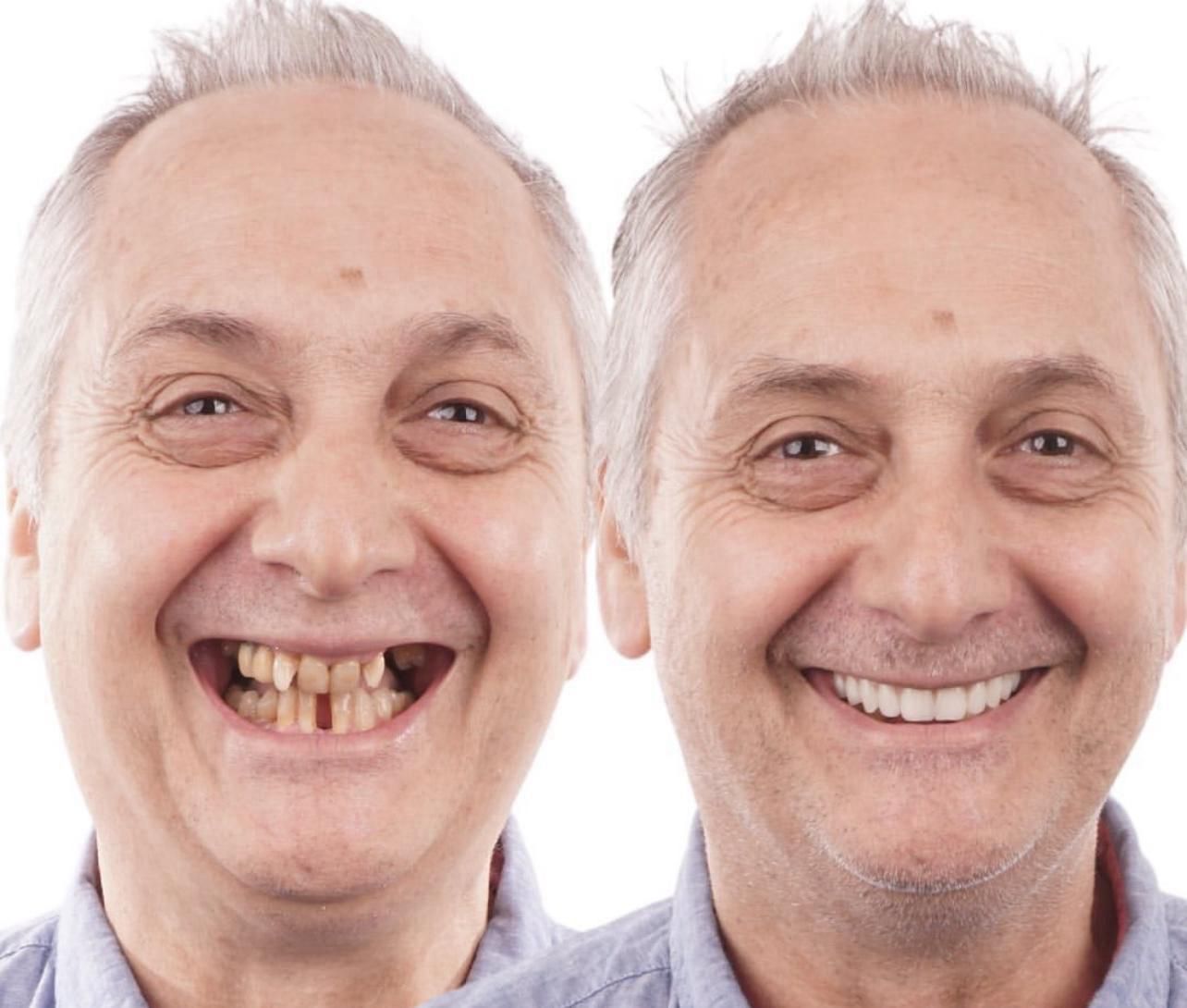 Dental aesthetics result