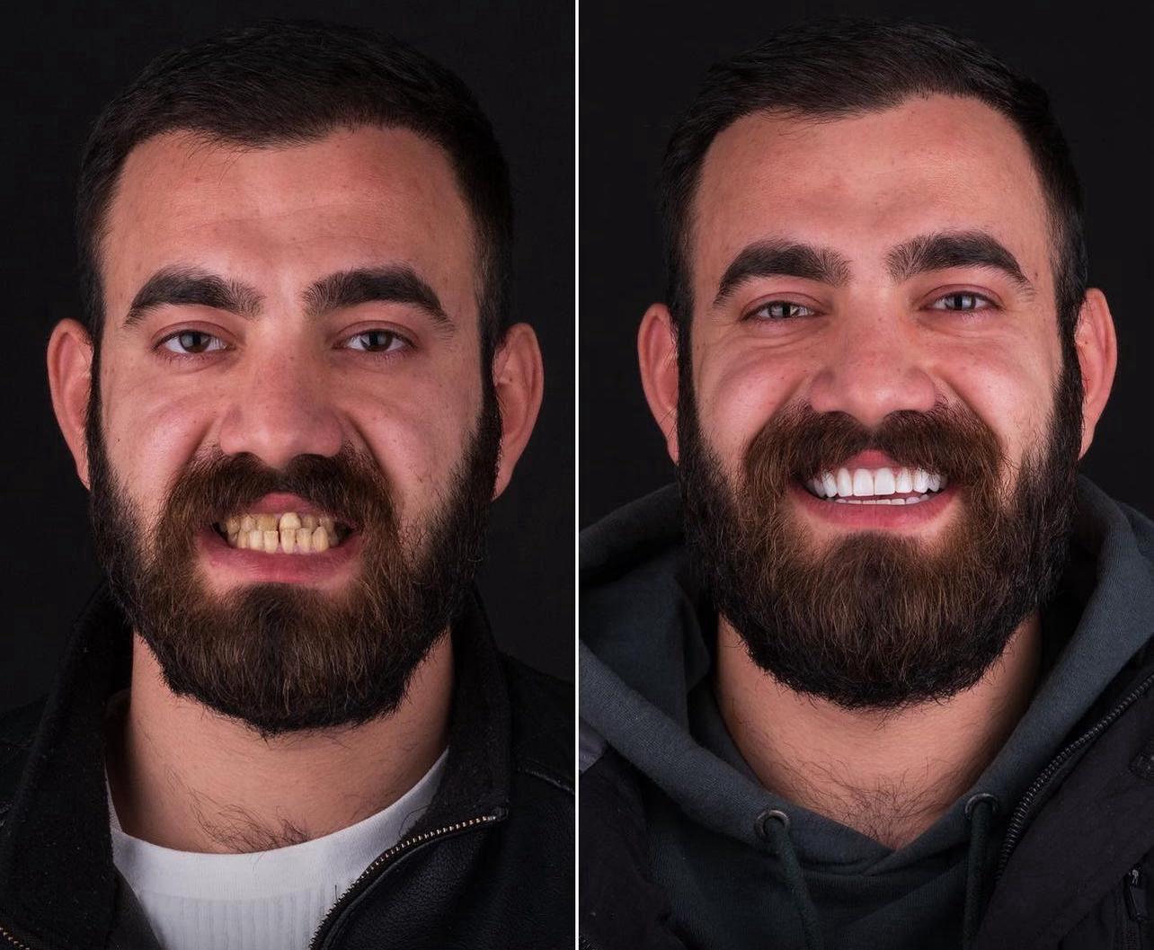 Dental aesthetics result